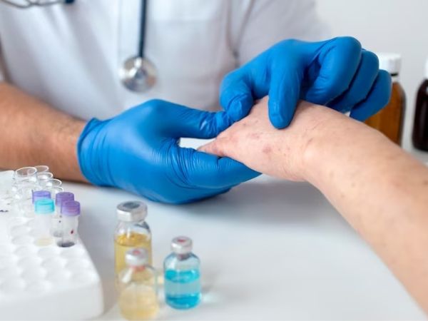 Why You Get Bruised Easily Why You Get Bruised Easily