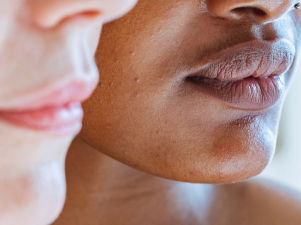 Holi: Skincare Tips For Dry Skin