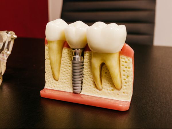 Bad Breath: 5 Quick Tips 