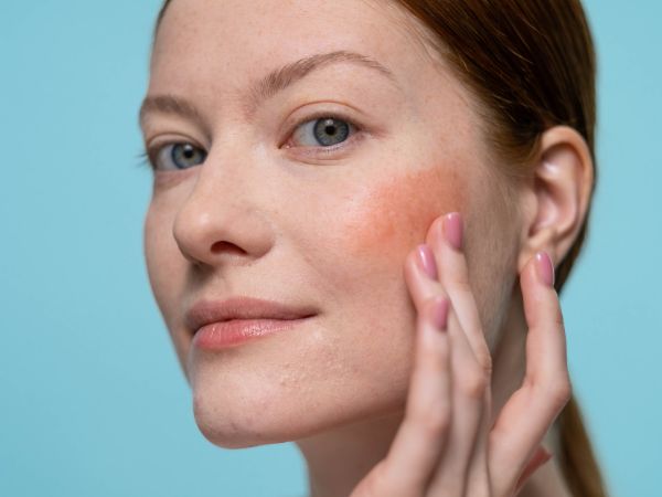 Humidity After Heatwave: Skincare Tips