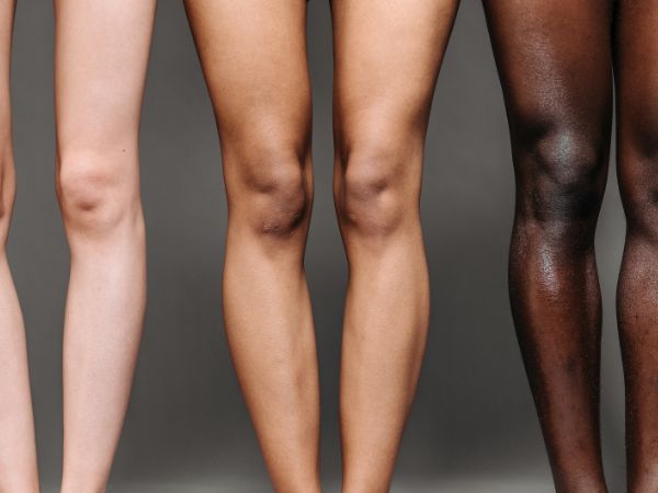 Tan Removal Home Remedies