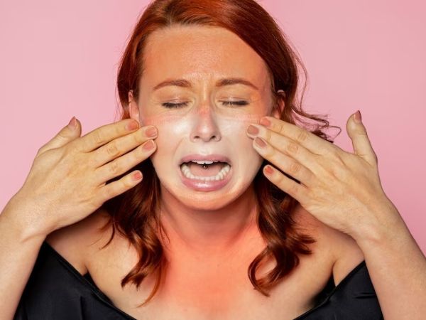 Tan Removal Home Remedies