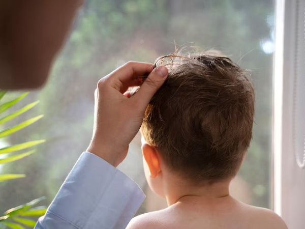 Baby’s Hair Falling Ou