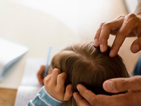 Baby’s Hair Falling Ou