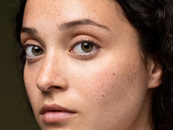 Face Packs To Get Rid Of Sun Tan Face Packs To Get Rid Of Sun Tan