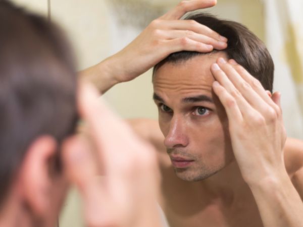 Hair Fall: When Should You See A Doctor Hair Fall: When Should You See A Doctor