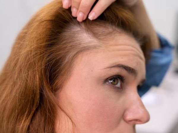 Hair Fall: When Should You See A Doctor Hair Fall: When Should You See A Doctor
