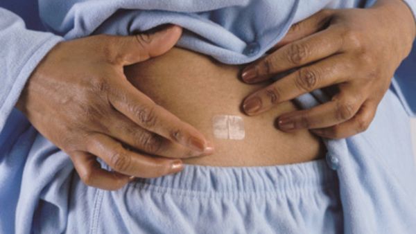 Can Menopause Patch Help With Symptoms?