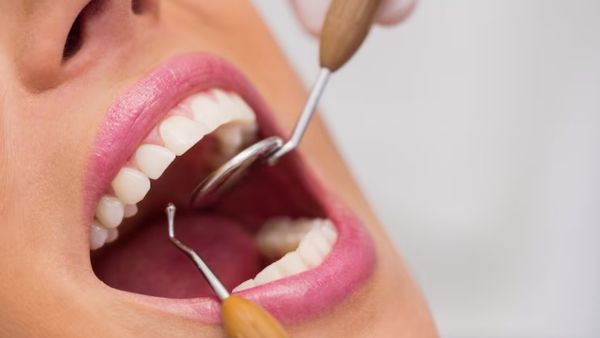 How To Clean Tooth Cavities At Home?