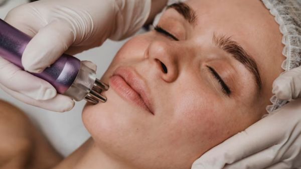 How To Remove Upper Lip Hair?