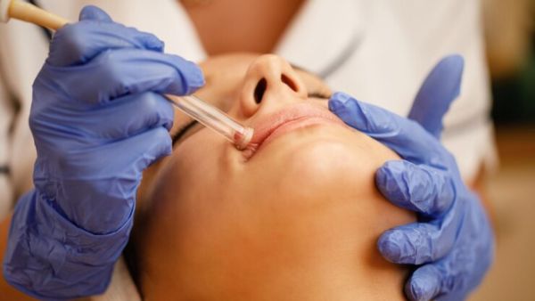 How To Remove Upper Lip Hair?