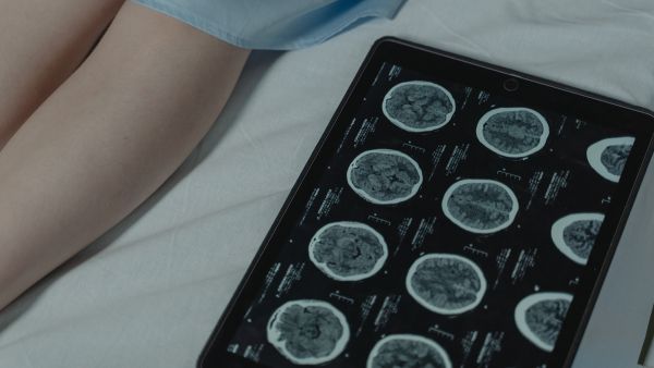 50th GST Council Meet: Cancer Medicine 50th GST Council Meet: Cancer Medicine