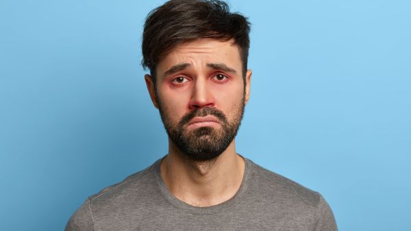 How Long Does Conjunctivitis Last