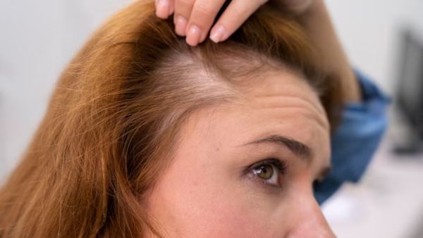 Hair Loss Remedy With Bhringraj