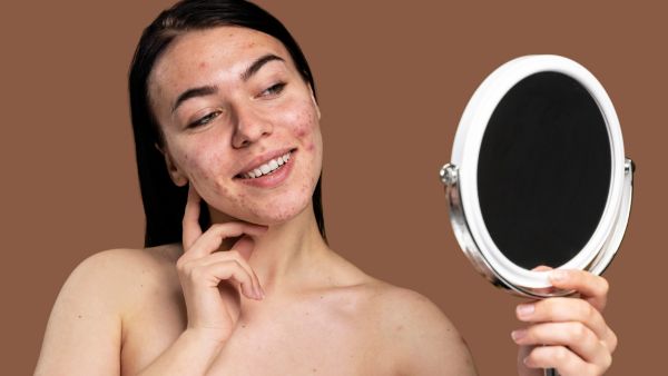 Onion Juice For Acne