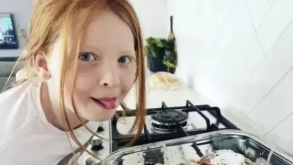 Complex Regional Pain Syndrome