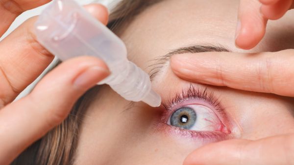 Prevent Conjunctivitis In Children