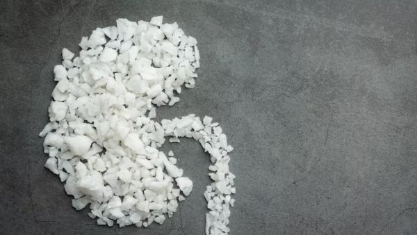 What Is Renal Cell Carcinoma