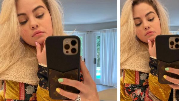 Things To Know Before Bleaching Hair