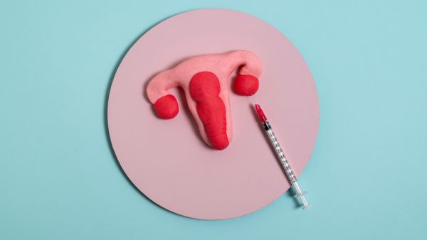 Uterine Artery Embolization For Fibroids