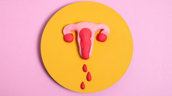 Uterine Artery Embolization For Fibroids