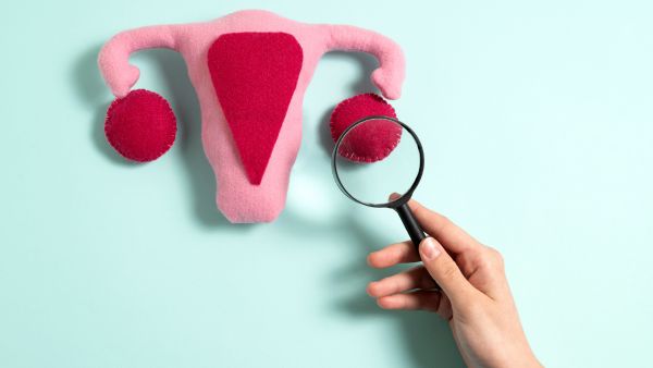 Uterine Artery Embolization For Fibroids