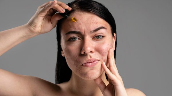 Sensitive Skin: Avoid These Ingredients