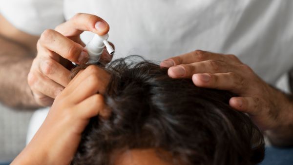 Myths vs Facts: Lice Only Grow On Clean Hair