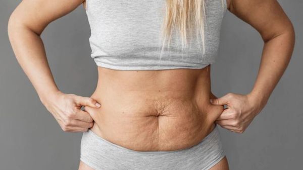 Liposuction Can Get Rid Of All Fat