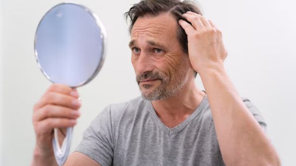 Diabetes Can Cause Heavy Hair Loss Diabetes Can Cause Heavy Hair Loss