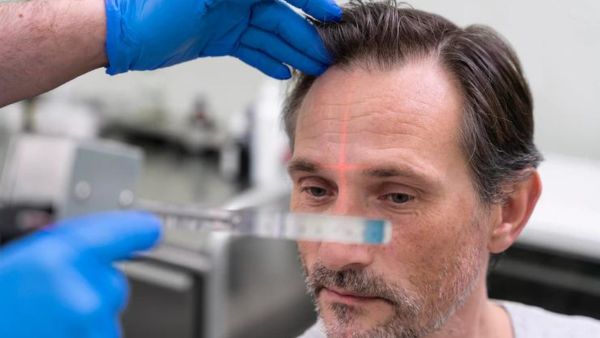 home-remedies-for-summer-hair-fall