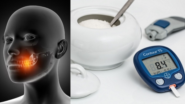 5 Tips For Eating Sugar Without Getting Cavities