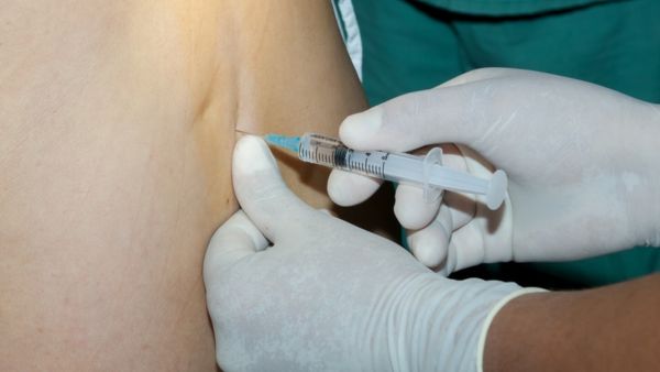 Are Epidurals Painful?