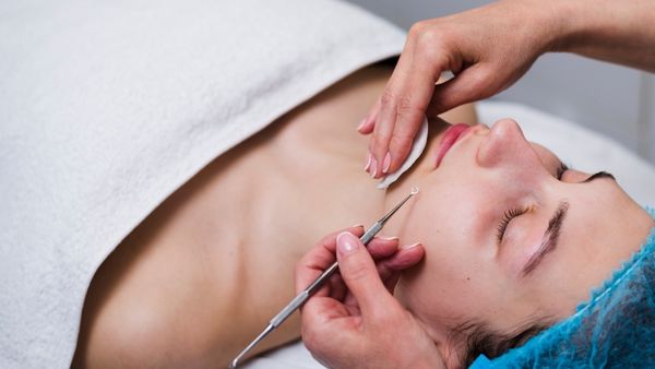 Tips To Remove Upper Lip Hair 