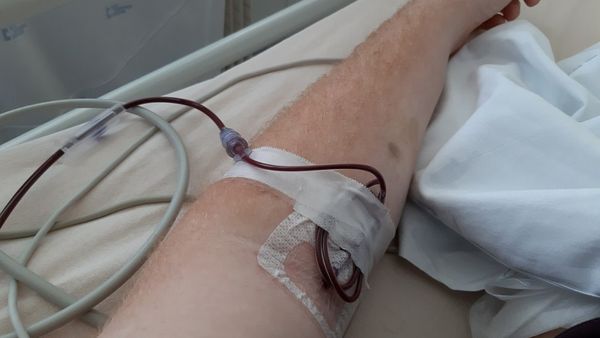 14 Children Infected With HIV In UP