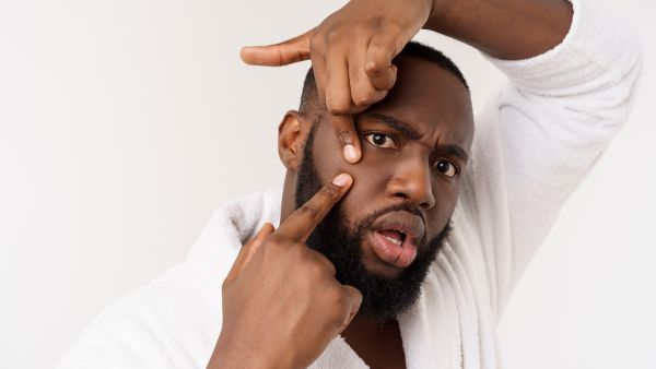 Remedy To Get Rid Of Pimple Marks Remedy To Get Rid Of Pimple Marks