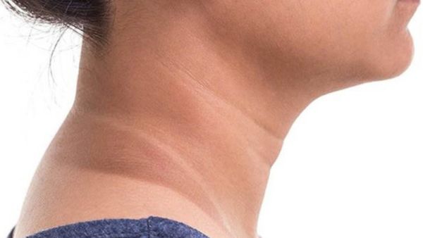 Erase Those Necklines: Tips