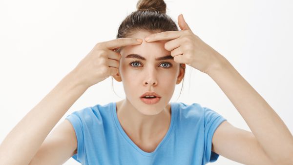 Medical Treatment For Acne And Pimples