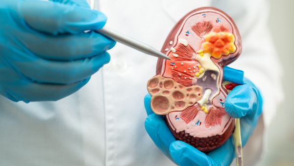 Signs Your Kidney Is Not Healthy!