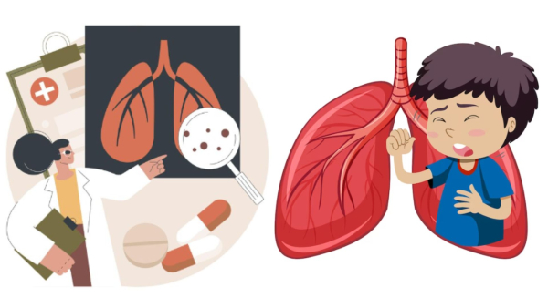  Pneumonia Outbreak: Doctor Shares Insights On How To Protect Children, Safety Practices and Guidelines 