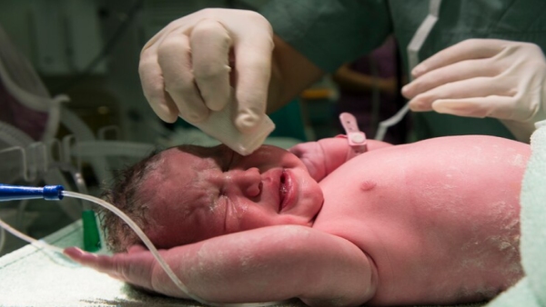 Challenges Premature Babies Face