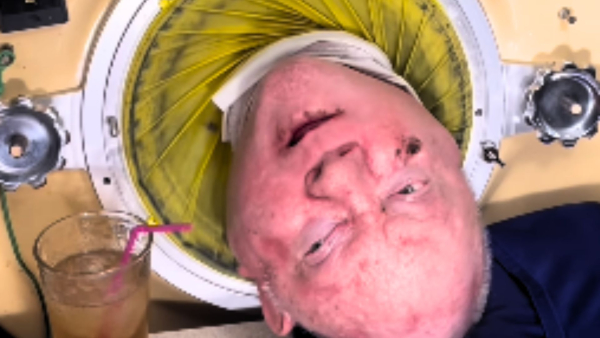 Paul Alexander Man In The Iron Lung Passes Away At 78 His Incredible Life Achievements