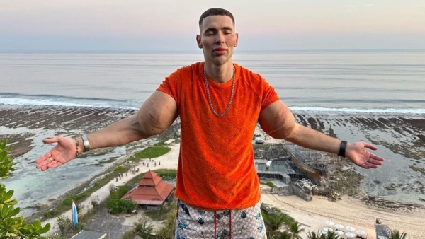 Russian Man Injecting Vaseline Into Muscles Is A Lesson In What You Should Not Try To Achieve Body Goals