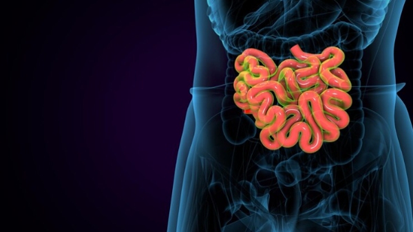 Bowel cancer also known as colorectal cancer is the third most common cancer worldwide and the second leading cause of cancer-related deaths Early detection is crucial for successful treatment and recovery