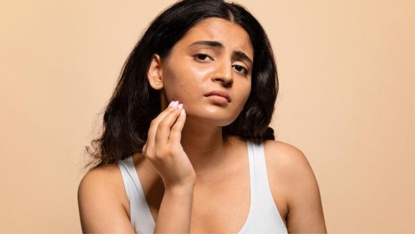 Survey Reveals Gen Z s Top Skin And Hair Woes In Monsoon Know The Solutions That Will Restore Your Beauty Survey Reveals Gen Z s Top Skin And Hair Woes In Monsoon Know The Solutions That Will Restore Your Beauty
