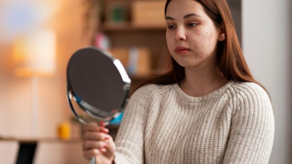 Benefits Of Going Makeup-Free