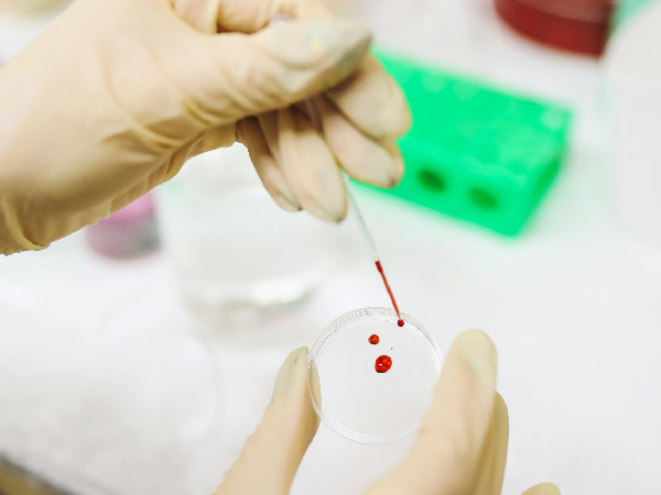 A Discovery Of A Rare Blood Type