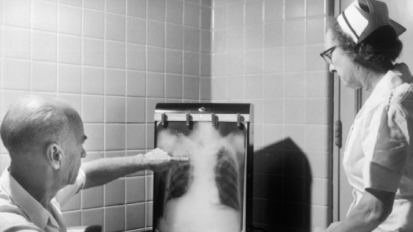 All About Tuberculosis