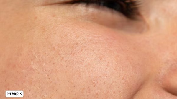 Skincare Myths Explained