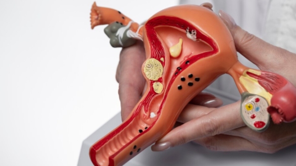 What Ancient Chinese Healers Knew About Cold Uterus And Why It Still Matters Expert Weighs In